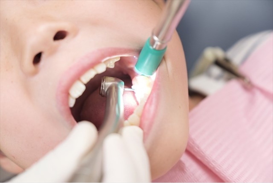 歯の治療はどうして回数がかかるのかについてのまとめ